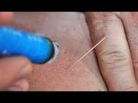 Vídeo 8