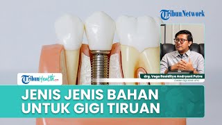 Jenis-Jenis Bahan Gigi Palsu serta Kelebihan dan Kekurangannya Menurut Dokter Gigi