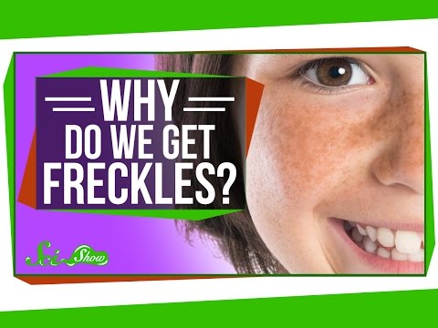 Why Do We Get Freckles?