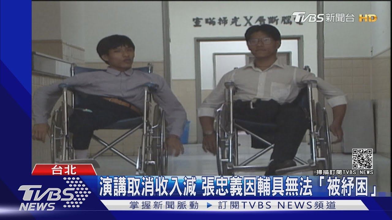 受贈輔具竟算所得 連體嬰張忠義紓困卡關