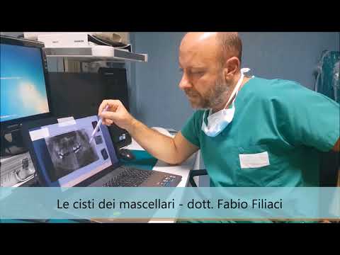 Fase di spondilosi cervicale Non prendere lesercito con osteocondrosi RB