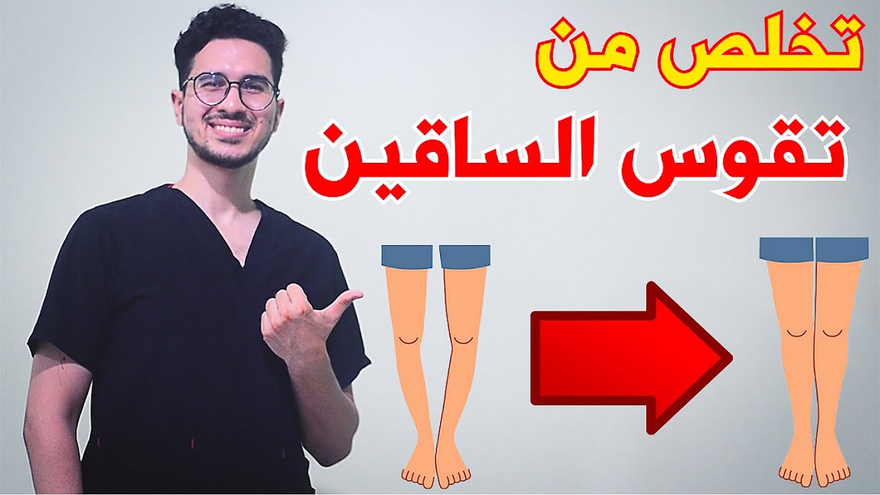 Treatment of bow legs in adults | Bow leg