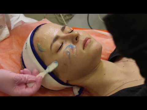 Пилинг Skin Tech easy droxy peel