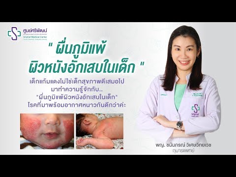 ยาสำหรับกลาก การรักษาใหม่สำหรับการรักษาโรคสะเก็ดเงิน