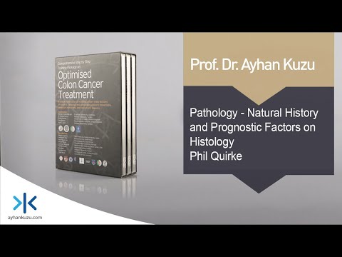 3.3.5. Pathology - Natural History and Prognostic Factors on Histology - Phil Quirke