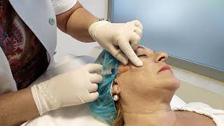 Mesoterapia facial a través de cánula, sin marcas. Central Clinic Sevilla