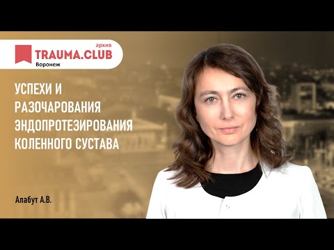 Точки для лечения суставов рук Мазь суставы пятигорск