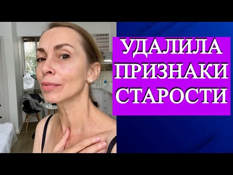 Признака старения, которые можно не заметить, но они забирают красоту