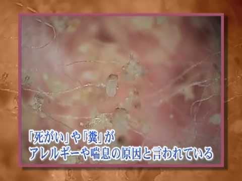鶏のワクモの治療法は何ですか?イエダニを駆除するために取るべき手順  庭園