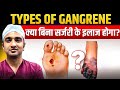 पैर काला पड़ने की वजह Gangrene तो नहीं What Is Gangren
