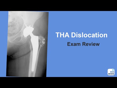 THA Dislocation Exam Review - Daniel Berry, MD