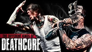 Download lagu The different kinds of DEATHCORE mp3 Download lagu The different kinds of DEATHCORE mp3