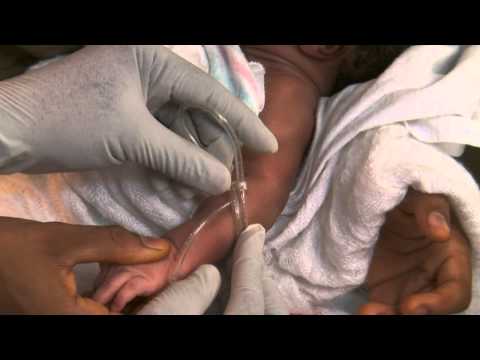 Newborn Care Series: Inserting an IV