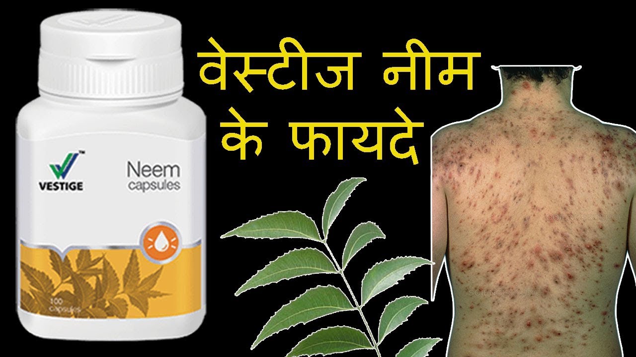 vestige neem capsules benefits in hindi | vestige Neem Ke Fayde | वेस्टीज नीम के फायदे