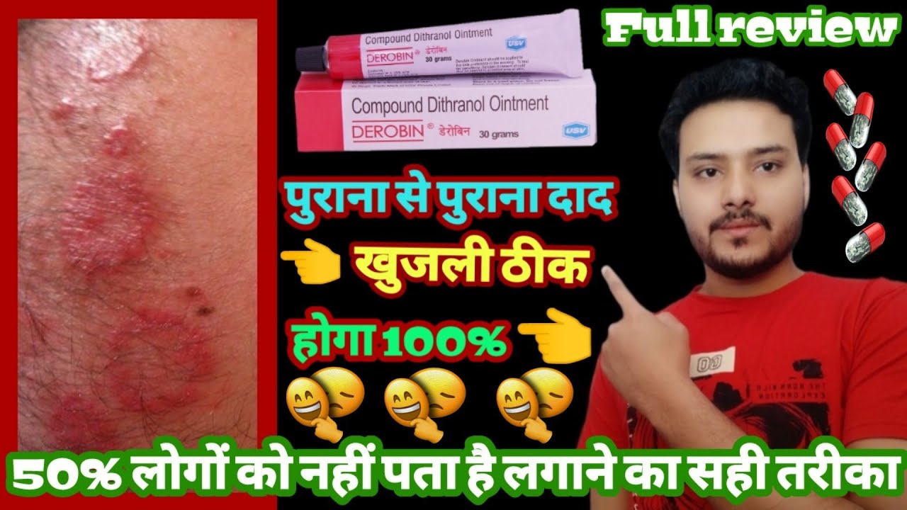 Derobin use in hindi|Derobin ointment (दाद खाज खुजली की दवा) Full review in hindi