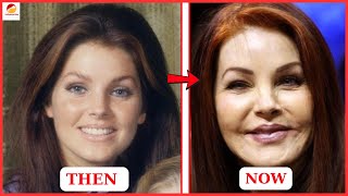 20 Hollywood Stars ... Who Destroyed Their Faces With Plastic Surgery! Part 2 Then And Now 2025