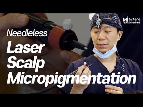 (eng) 무바늘 두피문신 소개 인터뷰 Needleless Laser Scalp Micropigmentation - 뉴헤어 I 두피문신
