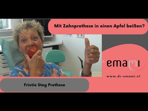 Gaumenfreie Prothese, Prothese auf Implantate, Steg Prothese, Feste Prothese, Druckknopf Prothese