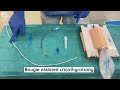 Bougie Assisted Cricothyrotomy