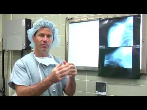 Cum să tratezi o articulație umflată