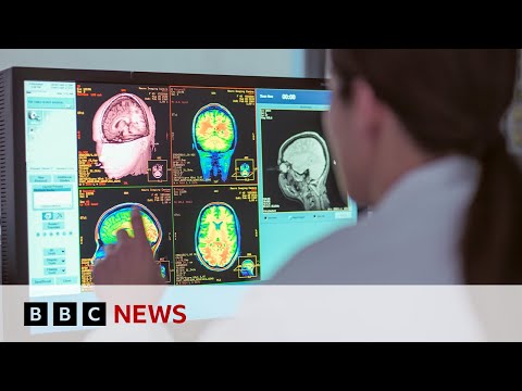 Video | Adolescence lasts into 30s, new study shows | BBC News