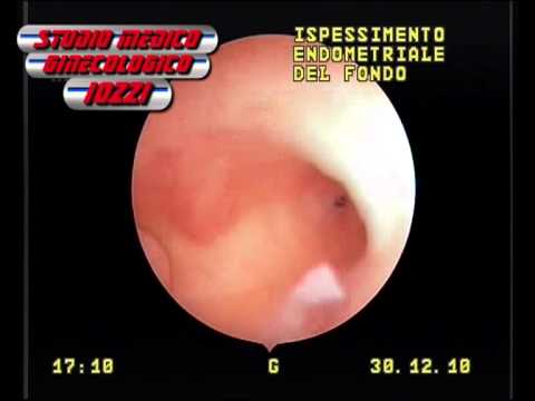 Standard di ispezione osteocondrosi Trattamento caviglia Osteosclerosi
