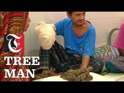 The "Tree Man" of Bangladesh