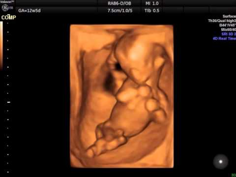 feto 4D 12 settimane