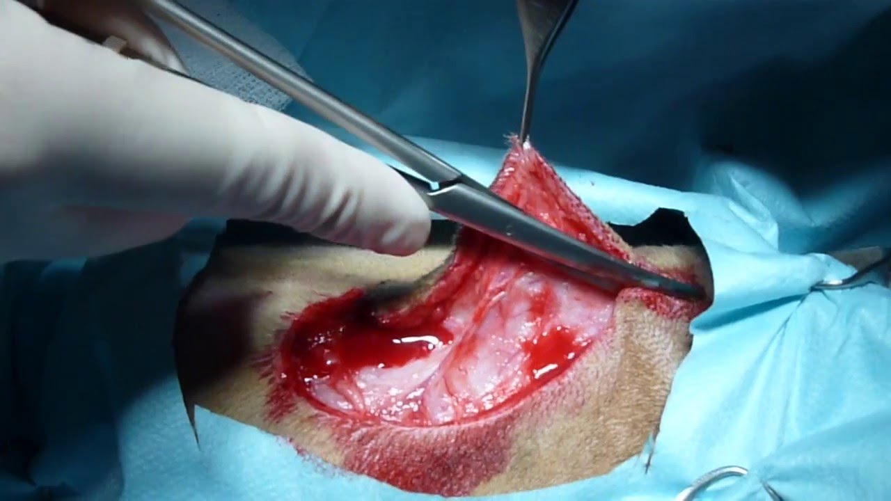 Extirpacio? de tumor subcutani - ALERTA IMATGES SENSIBLES