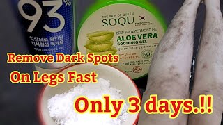 Remove Dark Spots, Mosquito Bites, Scar, Hyperpigmentation On Legs Fast Only 3 days.!!