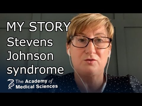 Patientenperspektive: Die SJS-Geschichte von Jane Burns