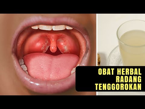 Potensi stroke Potensi obat tradisional untuk meningkatkan ulasan