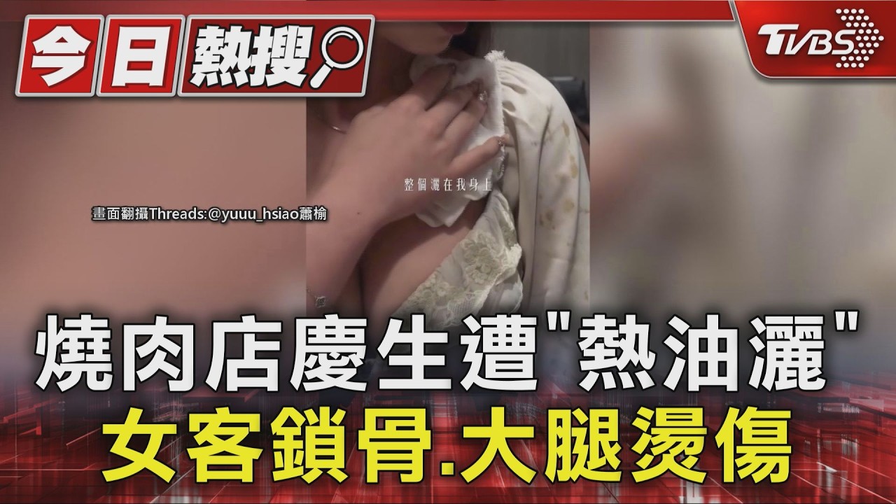 燒肉店慶生遭「熱油灑」 女客鎖骨.大腿燙傷 店家:全面檢討|TVBS新聞 @TVBSNEWS01