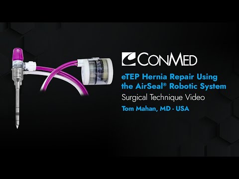 Dr. Tom Mahan - eTEP Hernia Repair Using AirSeal® Robotic Solution - CONMED Surgical Technique