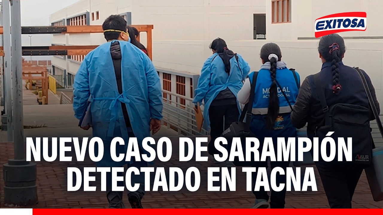 🔴🔵 Detectan segundo caso de sarampión en Tacna: Se trata de un menor de 10 años