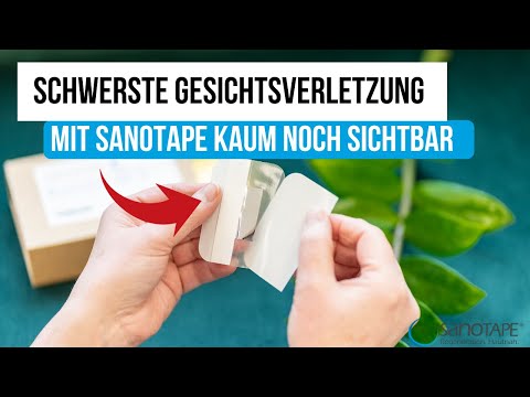 Uzi mit Hüftdysplasie bei Kindern Video-Training für den Rücken Osteochondrose
