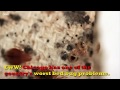 Chicago ranks No. 3 on Orkin's list of bed bug cities