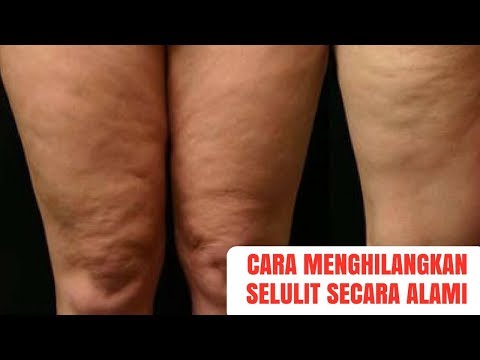 Menghitung kalori lemak protein dan karbohidrat aplikasi Membakar pulsa cardio lemak