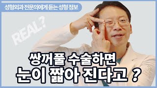 쌍꺼풀수술하면 눈이 짧아 진다고?