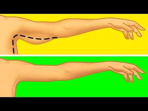 Sobra sa timbang Ana Kung paano mangayayat mabilis at walang kahirap-hirap