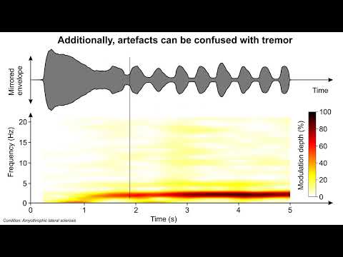 How to analyze vocal tremor