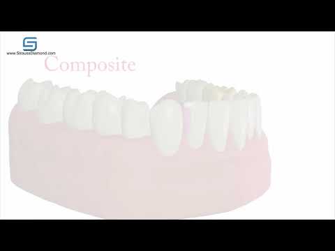 Strauss Diamond IPR and Magic Strip System