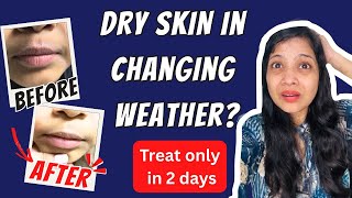 🧊 सिर्फ़ 2 दिन में फटे होंठों / त्वचा से पाएं छुटकारा 💋 – बदलते मौसम का 🌦️ Perfect Solution! ✅
