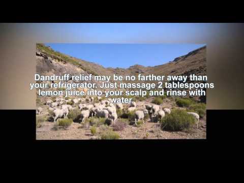download lagu mp3 mp4 Dandruff Quotes, download lagu Dandruff Quotes gratis, unduh video klip Dandruff Quotes