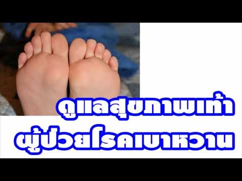 ชาเขียวสำหรับโรคสะเก็ดเงิน กลากบนฟุตรูปภาพ