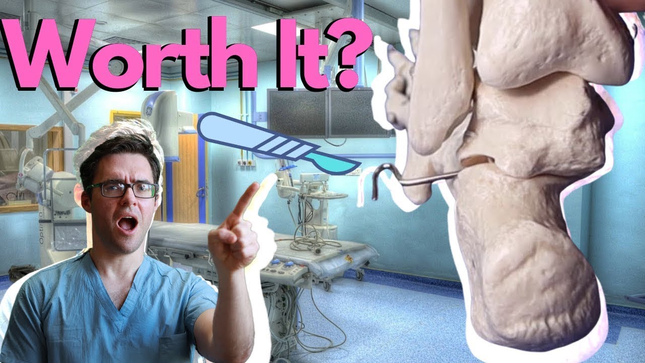 Is Flat Foot Surgery Worth It [Recovery Time & REAL RESULTS 2022!]