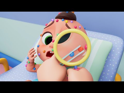 Candy Pox! | Say No to Too Much Candy | Fun Safety & Healthy Habits Cartoon for Kids by Baby Berry