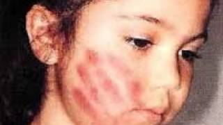 La tortura de Lyss. Melendi.