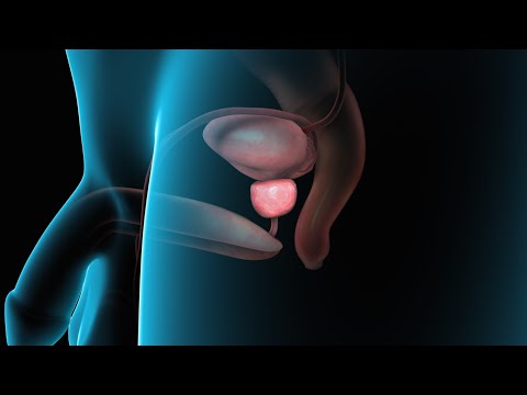 Was ist die Gefahr von Prostata-Fibrose Honig für Prostata