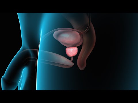 Prostatitis a férfiakban amelyek